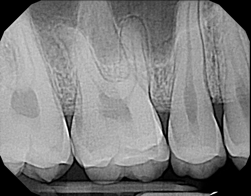 dentimax vs. dexis - dexis image