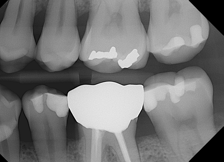 Open Sensor<br>Dental X-Ray Sensor - Image 2