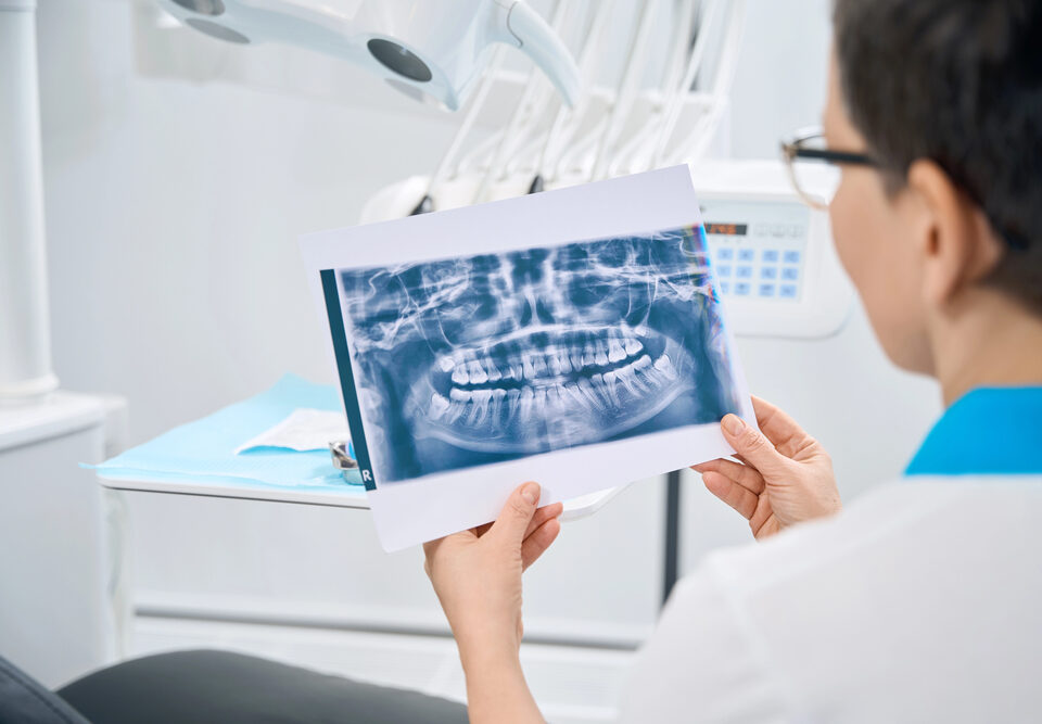 intraoral and extraoral x-rays